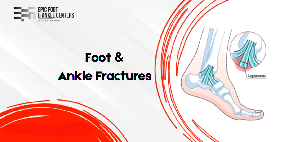 Foot and Ankle Fractures