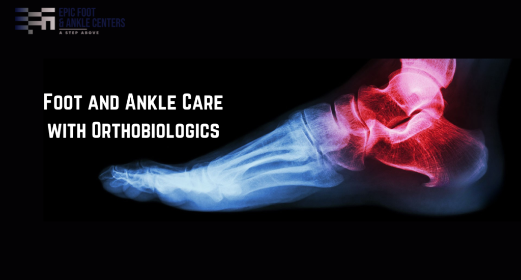 Foot and Ankle Care with Orthobiologics