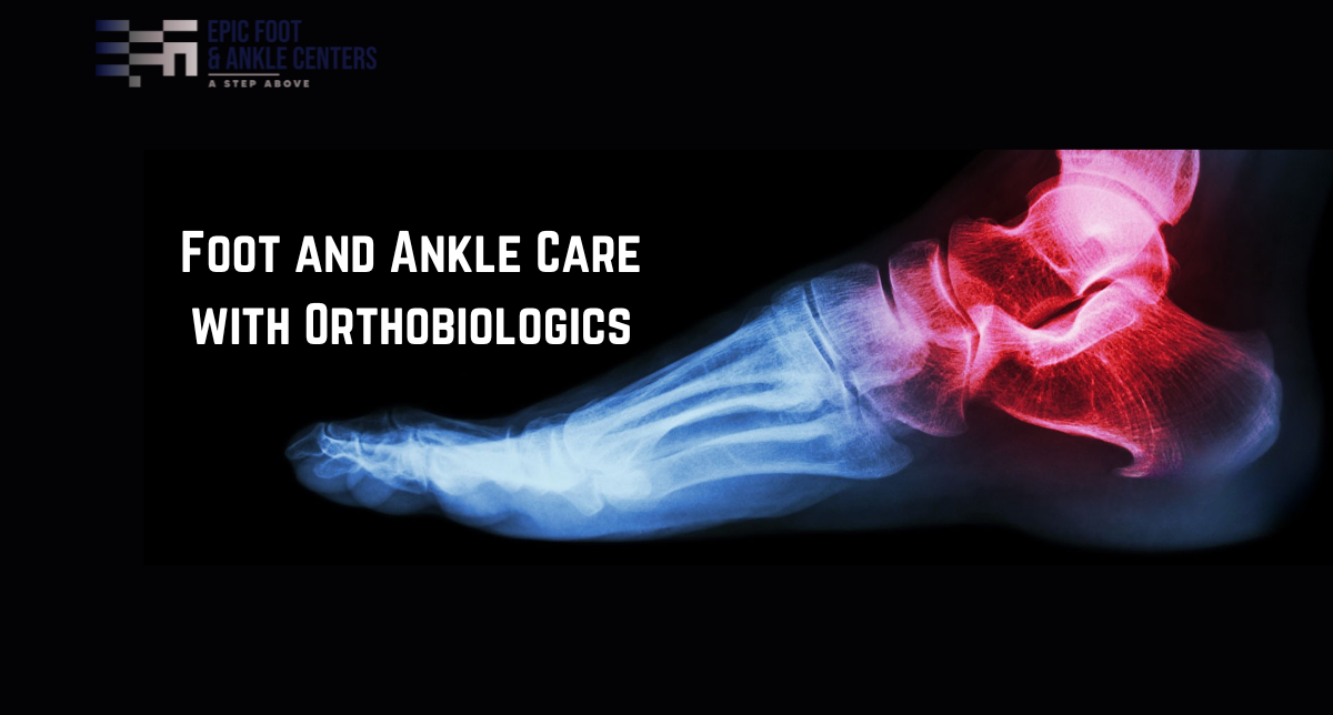 Foot and Ankle Care with Orthobiologics