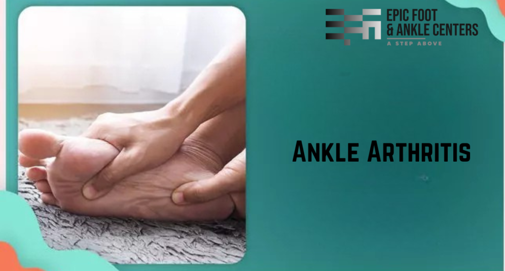 Ankle Arthritis