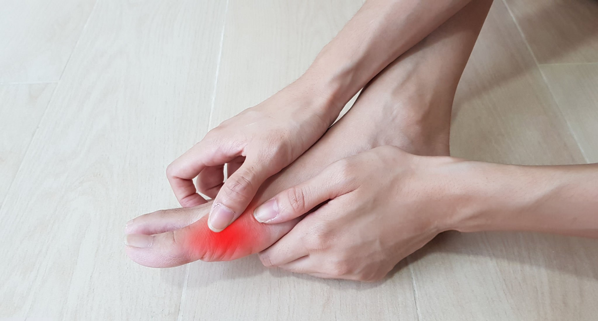 Bunion Surgery