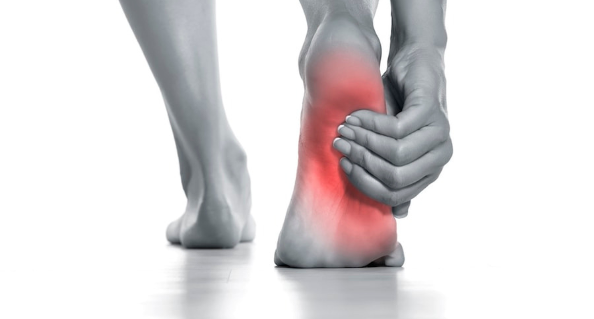 Top Treatment Strategies for Plantar Fasciitis & Achilles Tendonitis in Athletes